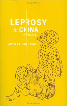 Leprosy in China